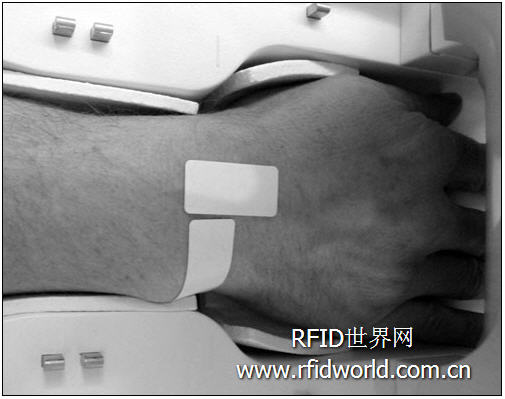 Swiss study finds that RFID tags can be safely used for MRI and CT scans