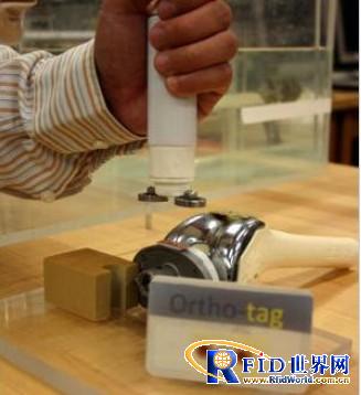 Pittsburgh researchers implanted RFID for orthopedic devices