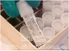 The world's first case of cancer pathological sample RFID control