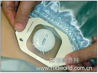 Singapore Tan Tock Seng Hospital uses RFID to automatically record patient temperature