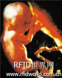 RFID ensures the accuracy of in vitro fertilization